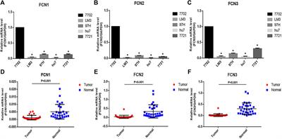 Comprehensive Analysis of Prognostic Value and Immune Infiltration of Ficolin Family Members in Hepatocellular Carcinoma